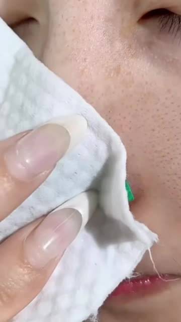 探索去黑头最新方法与技巧，黑头最新视频分享